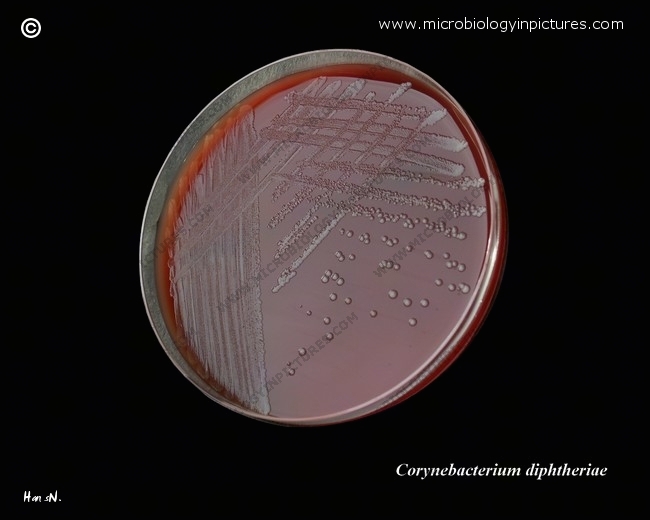corynebacterium diphtheriae on blood agar plate
